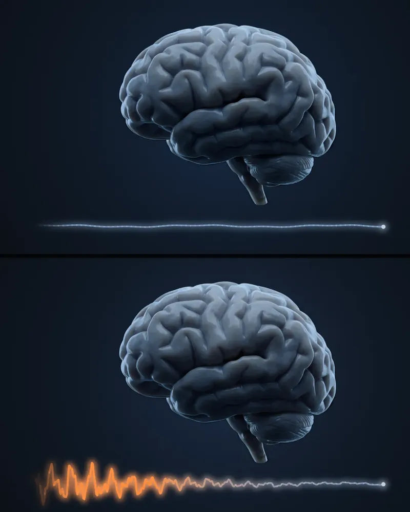 Split screen of the same brain, twice. Top: his alarm's same jagged sound passes through it again and again, and it stays dim, its brain-wave line flat. Bottom: a sound that gets stronger each time lights the same brain up bright orange, its line spiking.